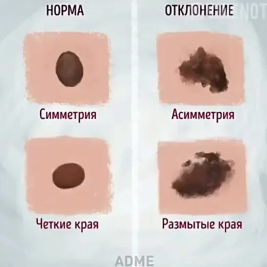 👩🏻‍⚕️Удалять или нет?
⠀
📌Родинки (невусы) встречаются практически у каждого человека. Они образуются из-за скопления в одном мес