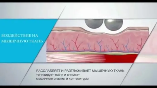 Революция, которая не имеет аналогов - #EndospheresTherapy!
•  формирует силуэт
•  борется с целлюлитом
•  способствует снижению