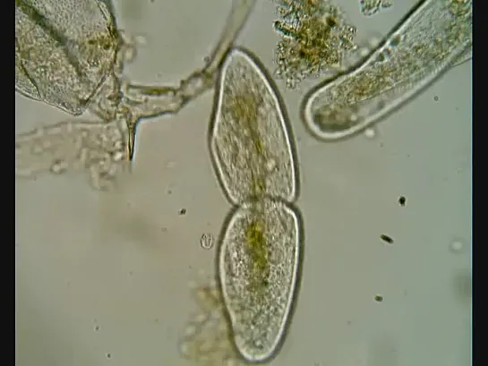 Делящаяся Paramecium