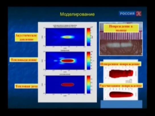 Academia. Олег Сапожников. Мощный ультразвук в медицине